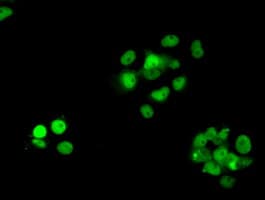 RPA2 / RFA2 / RPA34 Antibody (clone OTI9A1)