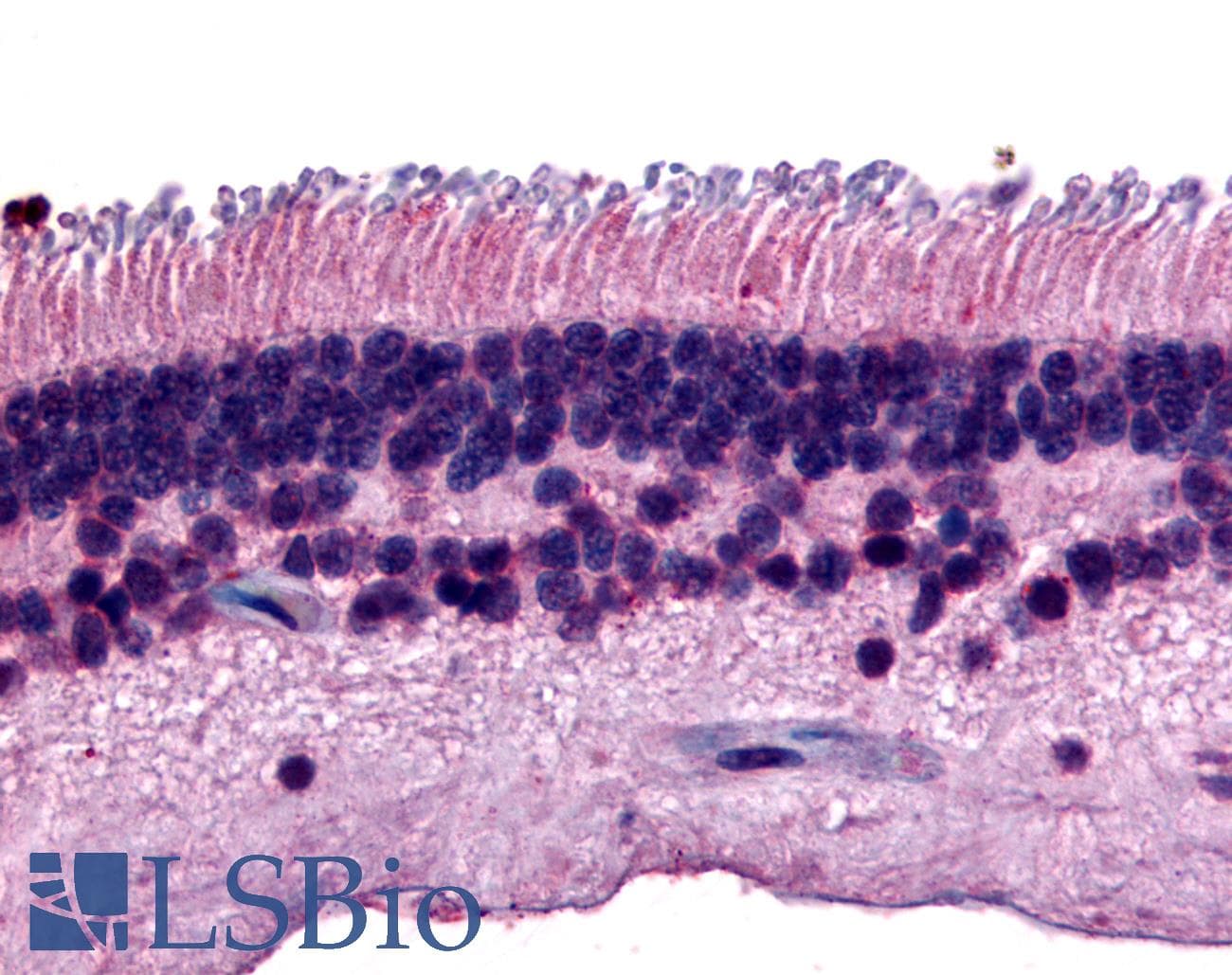 IHC-plus™ PTPRM / PTP Mu Antibody (Internal)