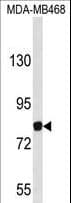 EVI5 Antibody (aa191-220)