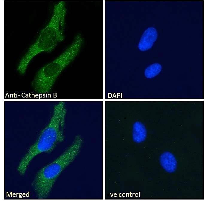 IHC-plus™ Polyclonal Goat anti-Human CTSB / Cathepsin B Antibody (Internal Region, IHC, IF)