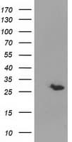 GSTT2 Antibody (clone OTI9A1)