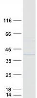 Human FBXL12 Protein (Recombinant Myc-DDK (Flag))