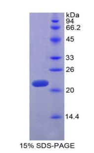 Rat TNFSF14 / LIGHT Protein (Recombinant His)