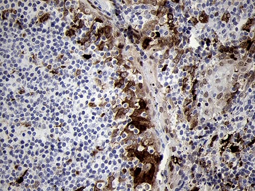 FSCN1 / Fascin Antibody (clone OTI3D2)