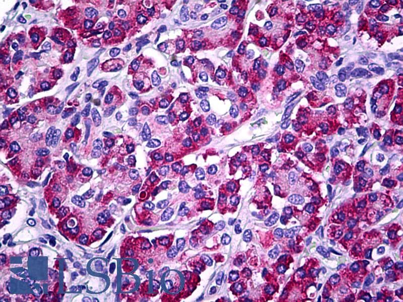 IHC-plus™ Monoclonal Rabbit anti-Human MESDC2 / MESD Antibody (clone C22F5, IHC, WB)