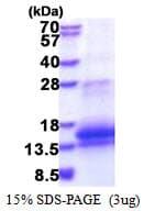 Human WFDC12 Protein (Recombinant His)