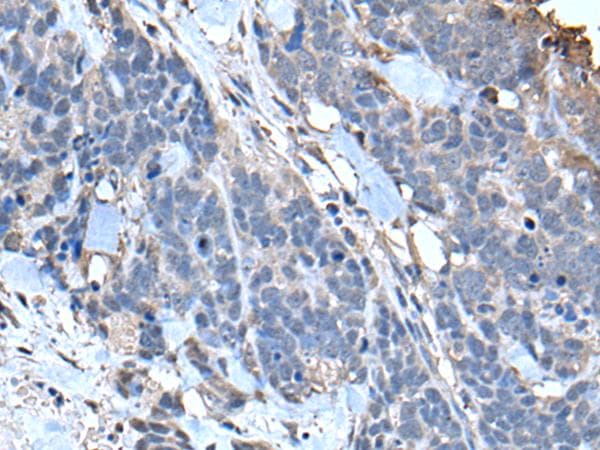 TPT1 / TCTP Antibody