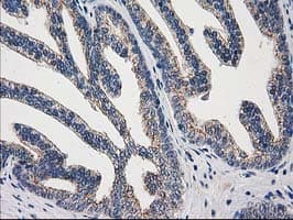 Monoclonal Mouse anti-Human ARFGAP1 Antibody (clone OTI1F6, IHC, IF, WB)