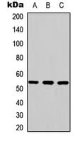 Polyclonal Rabbit anti-Human MAPK9 / JNK2 Antibody (Internal, IHC, WB)