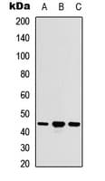 Polyclonal Rabbit anti-Human ACOT9 Antibody (Internal, IHC, WB)