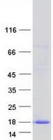 Human C2orf88 Protein (Recombinant Myc-DDK (Flag))