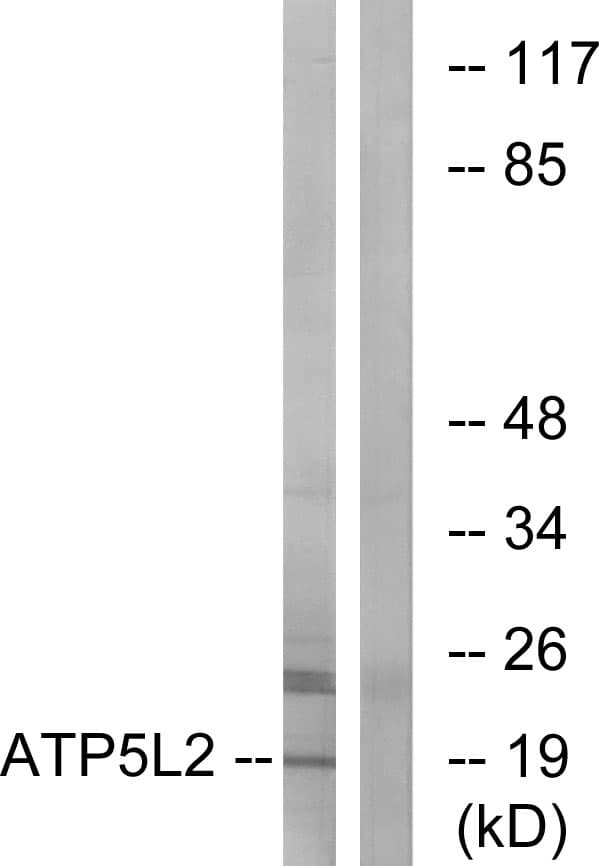 ATP5L2 Antibody (aa51-100)