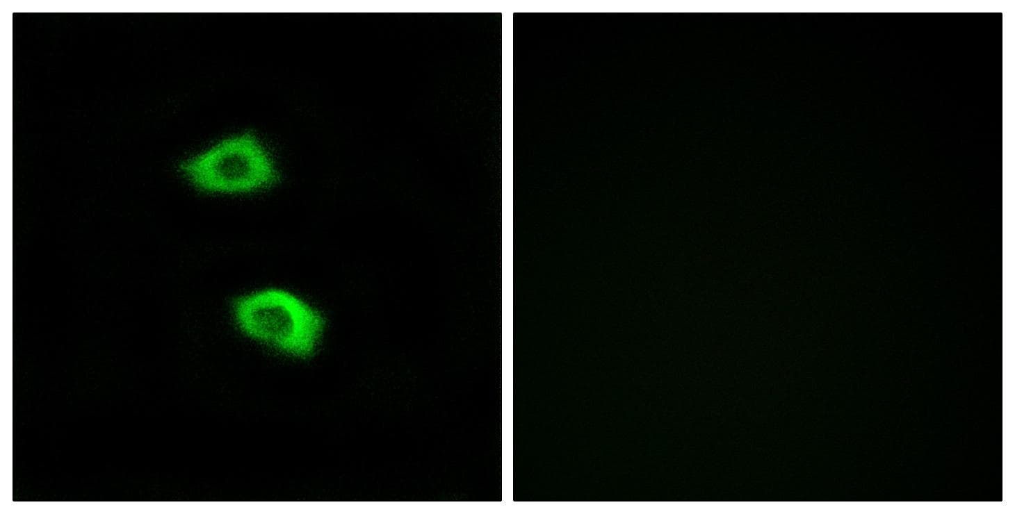 OR51B5 Antibody