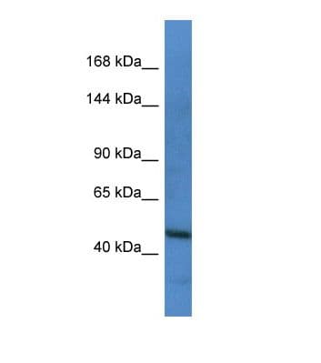 FLT1 / VEGFR1 Antibody (C-Terminus, FITC)