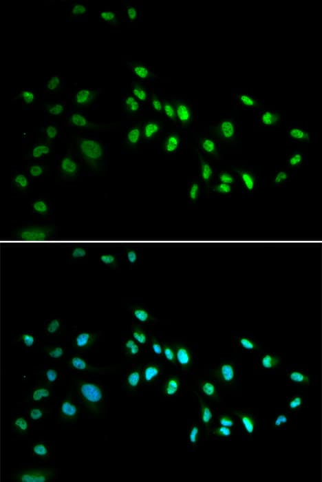 DNMT3A Antibody