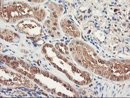RNPEP Antibody (clone OTI3B5)