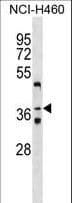 Polyclonal Rabbit anti-Human ZNF691 Antibody (aa86-113, WB)