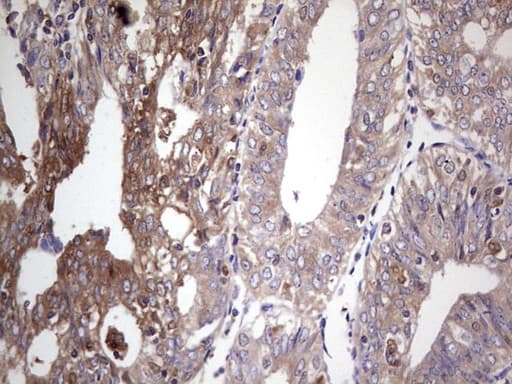 Monoclonal Mouse anti-Human PKM2 Antibody (clone 1F12, IHC, WB)