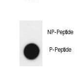 KDM4A / JHDM3A / JMJD2A Antibody (phospho-Tyr547)