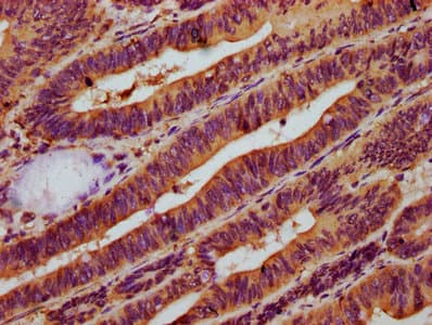 Polyclonal Rabbit anti-Human NAGPA Antibody (IHC, WB)