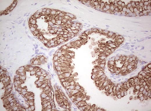 Basic Cytokeratin AE3 Antibody (clone AE3)