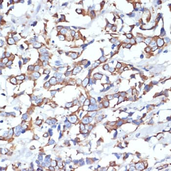 KRT18 / CK18 / Cytokeratin 18 Antibody