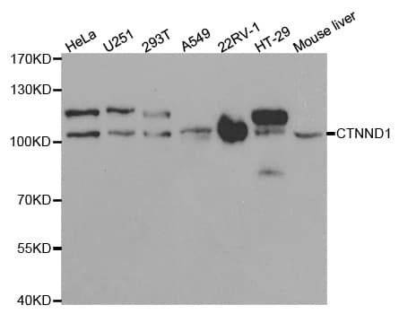 CTNND1 / p120 Catenin Antibody