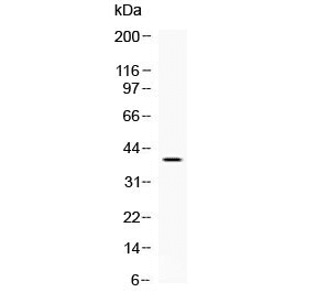 Polyclonal Rabbit anti-Mouse MC2R / ACTHR / ACTH Receptor Antibody (WB)
