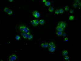 Monoclonal Mouse anti-Human BTK Antibody (clone OTI10E10, IHC, IF, WB)