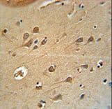 Monoclonal Mouse anti-Rat DLG4 / PSD95 Antibody (aa677-706, IHC, WB)