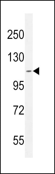Polyclonal Rabbit anti-Human ATP8B2 Antibody (aa18-47, WB)