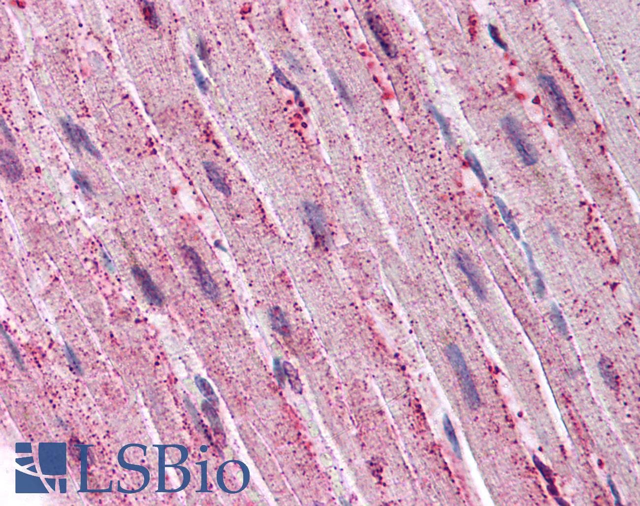 IHC-plus™ Polyclonal Rabbit anti-Human ADAMTS4 Antibody (C-Terminus, IHC)
