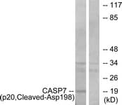 CASP7 / Caspase 7 Antibody (aa149-198)