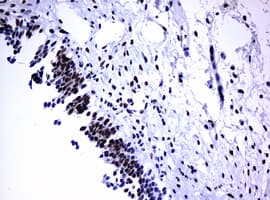 Monoclonal Mouse anti-Human PCNA Antibody (clone OTI1D11, IHC, WB)
