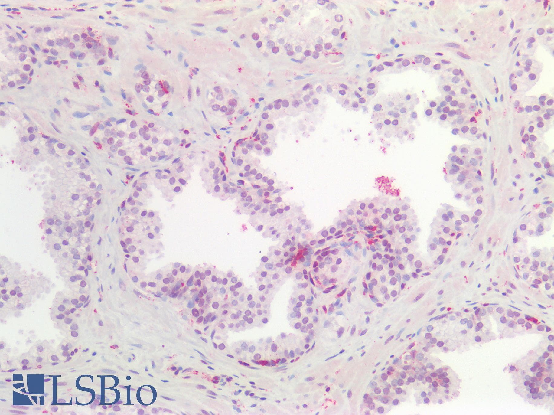 IHC-plus™ Polyclonal Rabbit anti-Human FZD7 / Frizzled 7 Antibody (IHC, WB)