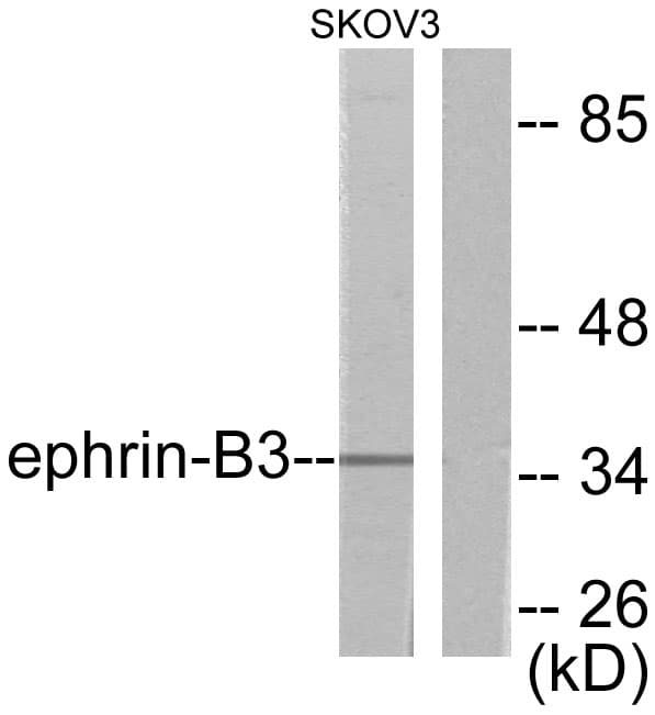 Polyclonal Rabbit anti-Human EFNB3 / Ephrin B3 Antibody (aa221-270, IHC, WB)