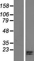 Human CCDC196 Protein (Over-Expression Lysate Myc-DDK (Flag))