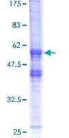 Human XRCC2 Protein (Recombinant GST)