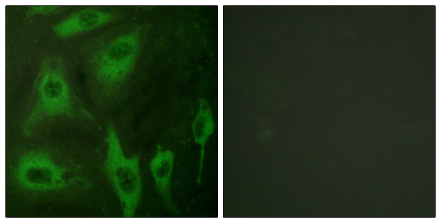 AQP2 / Aquaporin 2 Antibody (aa222-271)