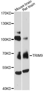 Polyclonal Rabbit anti-Human SPRING / TRIM9 Antibody (WB)