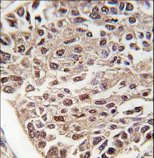 Polyclonal Rabbit anti-Human SRSF2 / SC35 Antibody (aa9-39, IHC, WB)