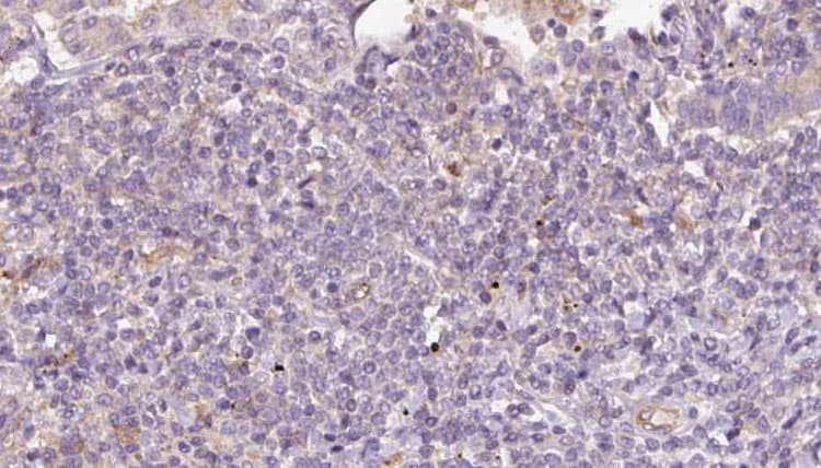 STT3B Antibody