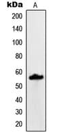 Polyclonal Rabbit anti-Human MUC13 Antibody (C-Terminus, IHC, IF, WB)