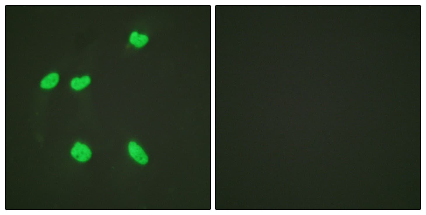IHC-plus™ Polyclonal Rabbit anti-Human Histone H4 Antibody (Lys16, IHC, IF)