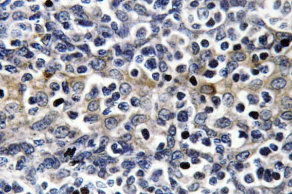 VASP Antibody (Ala232)