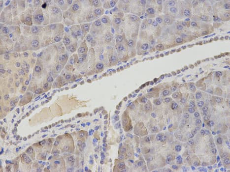 IHC-plus™ Polyclonal Rabbit anti-Human ASNS Antibody (IHC, IF, WB)
