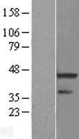 RNF113A Protein (Over-Expression Lysate Myc-DDK (Flag))