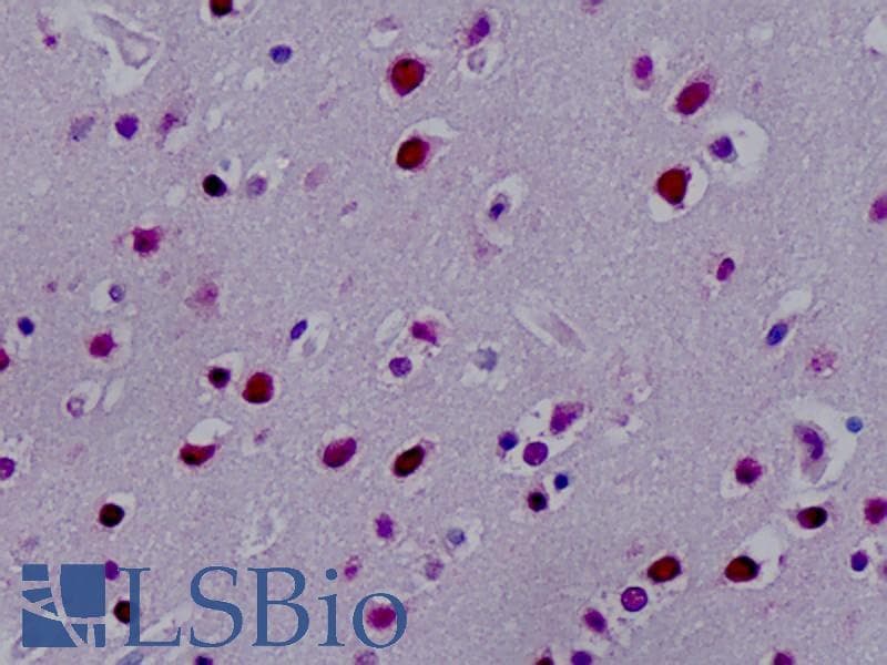 IHC-plus™ Polyclonal Rabbit anti-Human SYNCRIP / HnRNP Q Antibody (aa236-285, IHC, IF, WB)