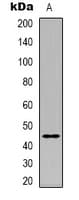 Polyclonal Rabbit anti-Human RPSA / Laminin Receptor Antibody (Internal, IHC, WB)