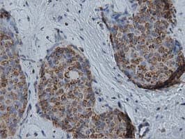 IVD Antibody (clone OTI1B10)